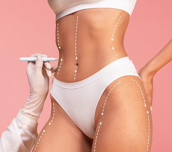 After lipo massage