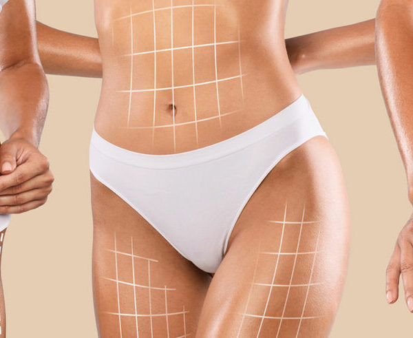 Liporedux behandeling