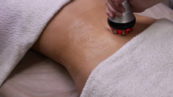 Ultrasound Cavitatie behandeling