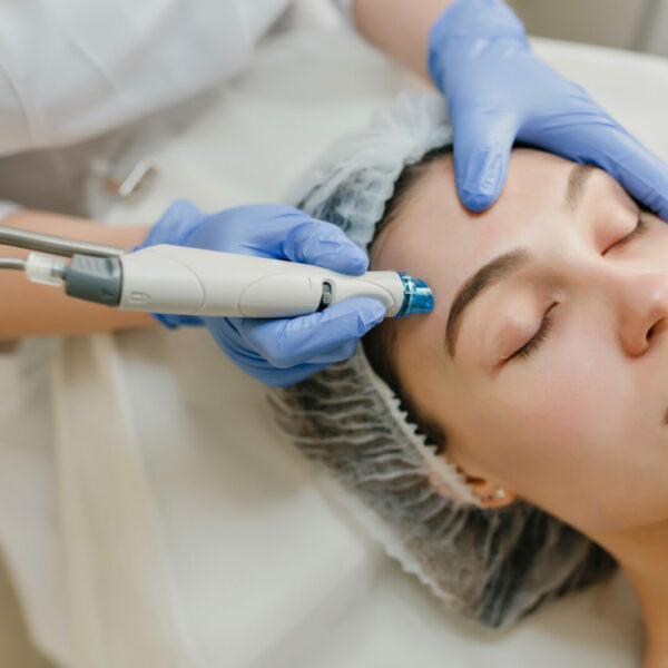 Dermapen (microneedling)