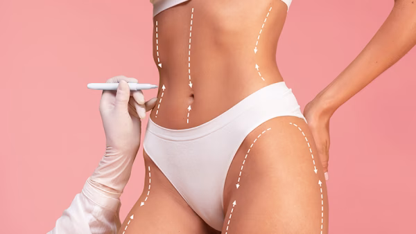 After lipo massage
